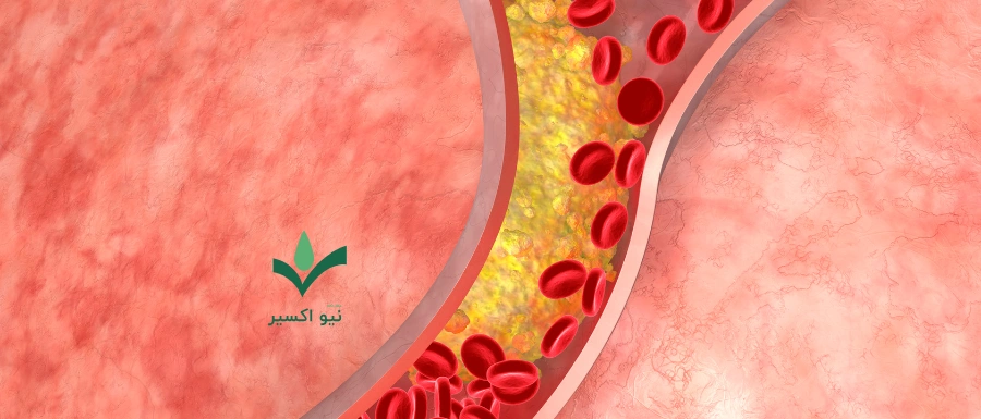 کاهش کلسترول با چای ماچا